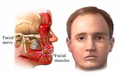 Facial Palsy Causes And Treatments New Health Advisor