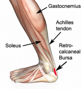 Posterior Calcaneal Spur