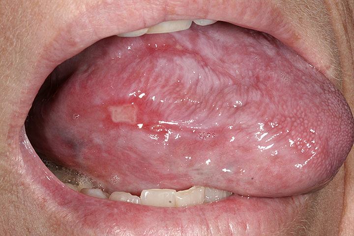 Penis Tongue 68